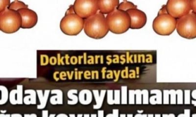 Oturma Odasına Soğan Koyunca, Doktorları Şaşkına Çeviren Fayda